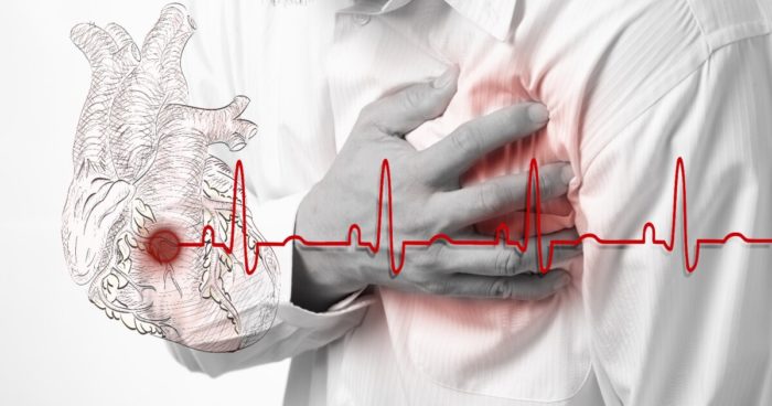 Bệnh cao huyết áp gây biến chứng tim mạch rất nguy hiểm